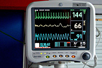 Afbeelding van een hartslagmonitor